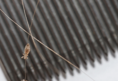 headlice on comb